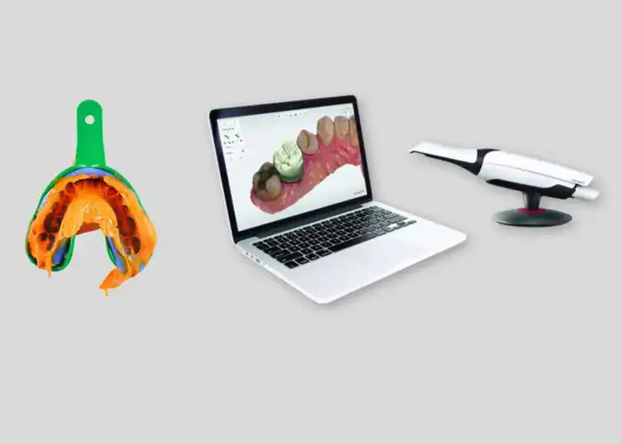 Trios Intraoral Scanner vs Traditional Impressions