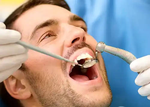 Dental Check Up Bundaberg QLD